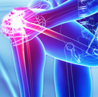 A person holding on to their sore knee